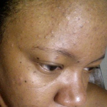 Client result 9 before using KlutchJa Organics products