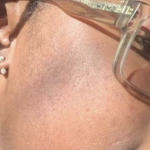 Client result 4 after using KlutchJa Organics products