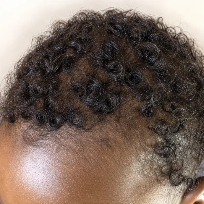 Client result 6 after using KlutchJa Organics products